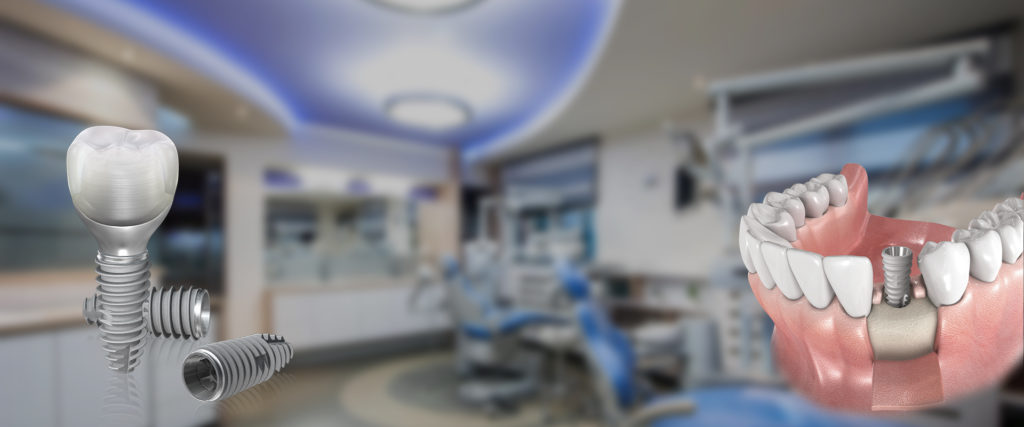 Импланты NeoBiotech Томск Источный Пломбирование молочных зубов Томск Промышленный