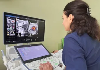 Що таке УЗД діагностика: переваги та особливості методу